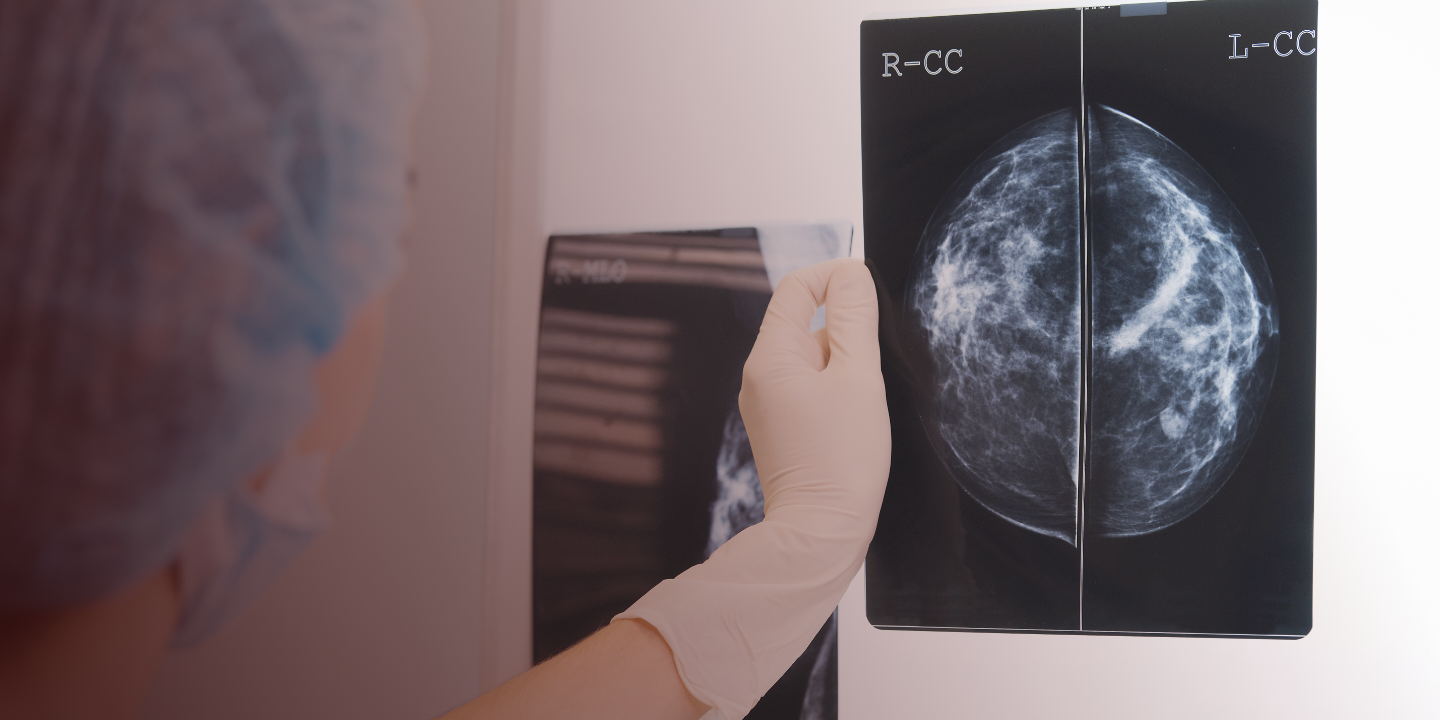 Diagnóstico y síntomas del cáncer de mama metastásico 